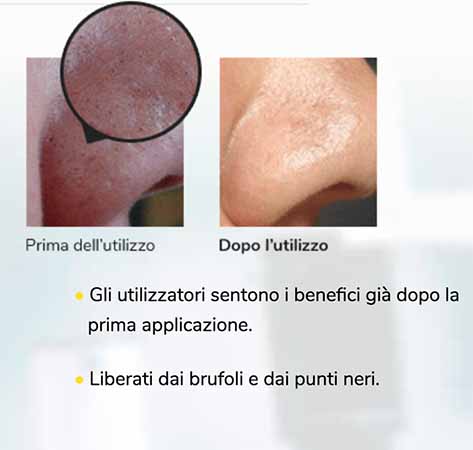 Maschera viso punti neri